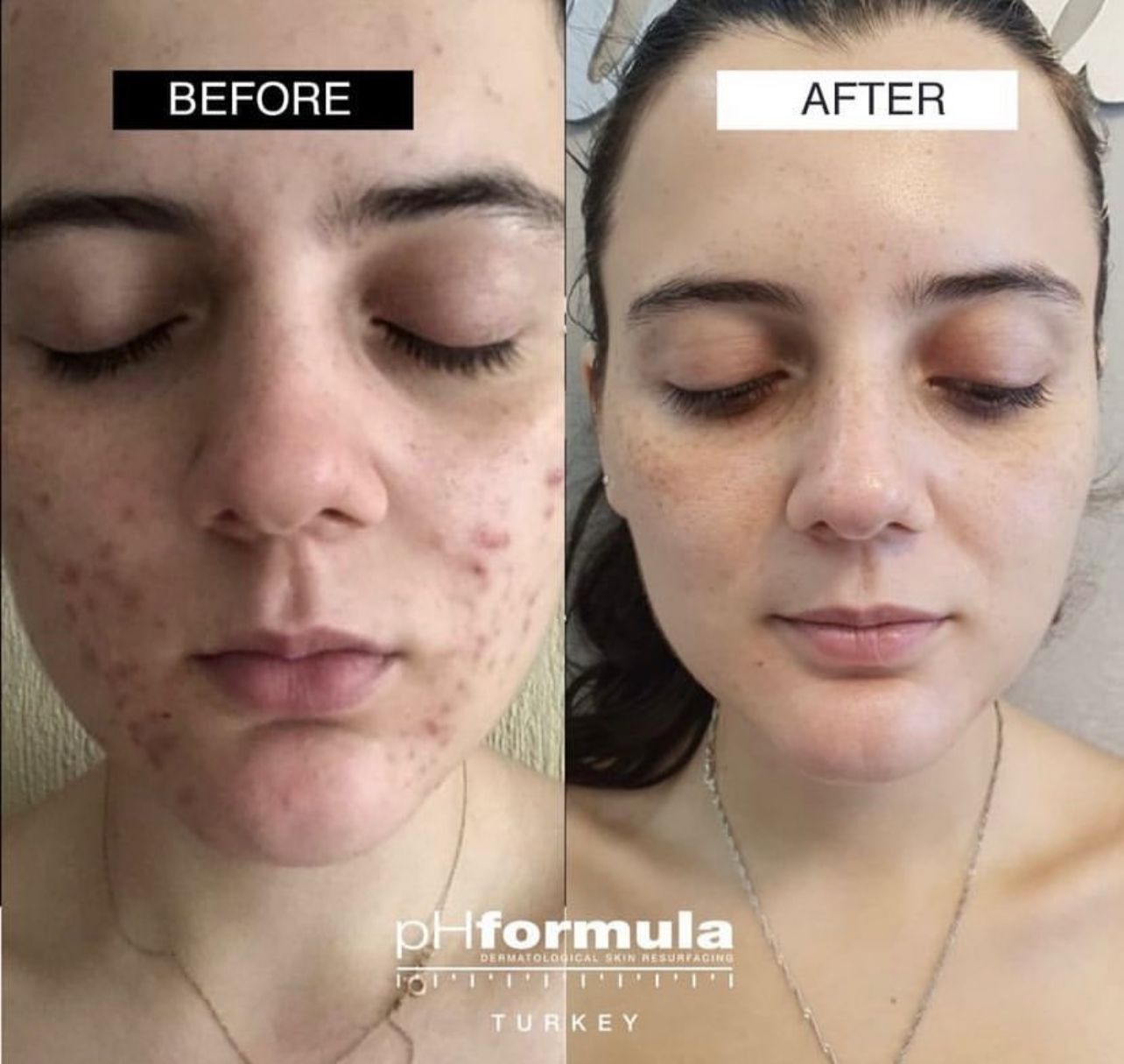 Mersin Cilt Bakımı, Cilt Bakımı Mersin, Mersin Cilt Bakımı Fiyatları, Mersin Profesyonel Cilt Bakımı, Mersin Cilt Bakımı Fiyatı